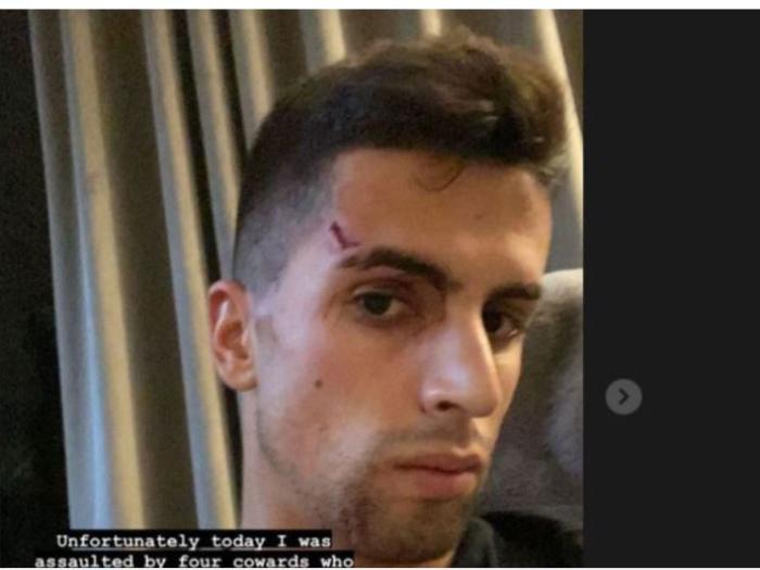 英超球星遭犯罪团伙盯上 升级安保应对频发盗窃